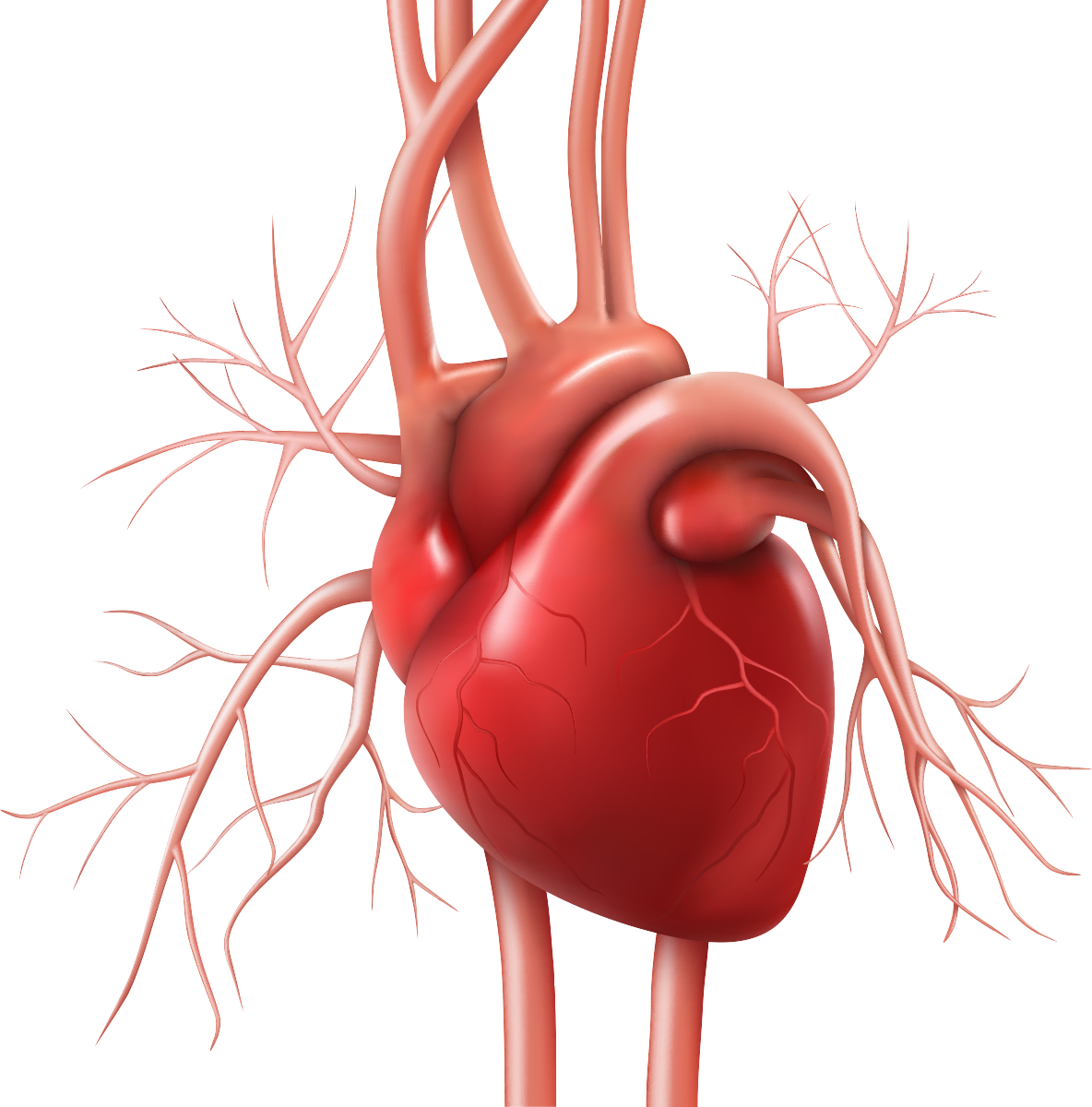 Cathlab Plus - Abbott